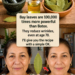 Bay leaves are 100,000 times more powerful than Botox. They eliminate wrinkles, even at age 70