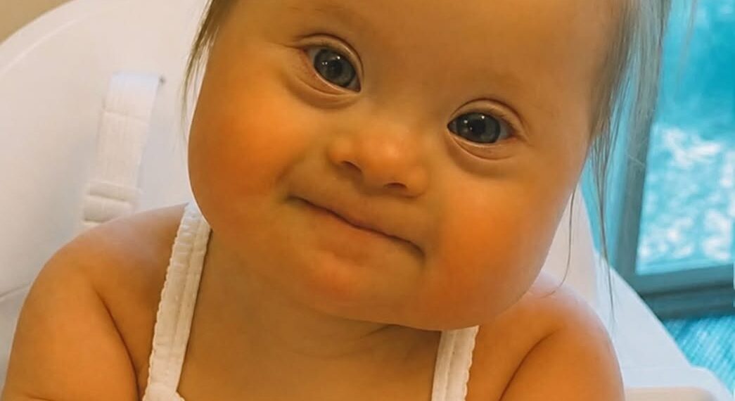 When the doctor said, “Your baby has Down syndrome,” her mother cried… But months later, this little girl changed everyone’s hearts.