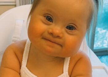 When the doctor said, “Your baby has Down syndrome,” her mother cried… But months later, this little girl changed everyone’s hearts.