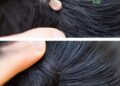 Just discovered this in my son’s hair. What is it? Not sure if we should go to doc