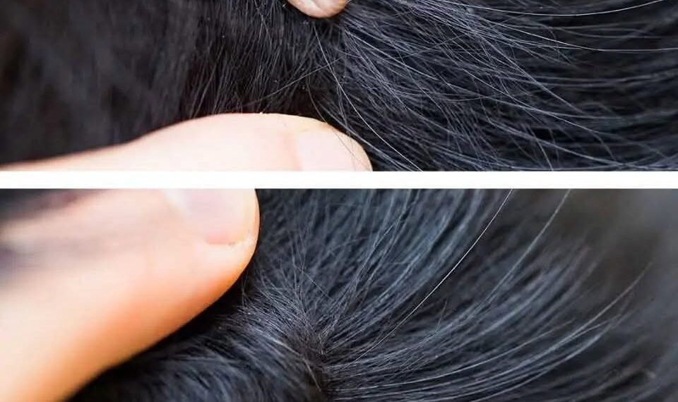 Just discovered this in my son’s hair. What is it? Not sure if we should go to doc