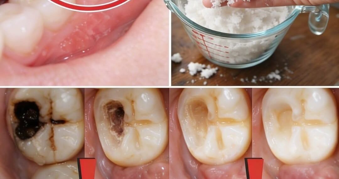 Smart Habits to Protect Your Teeth