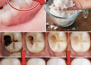 Smart Habits to Protect Your Teeth