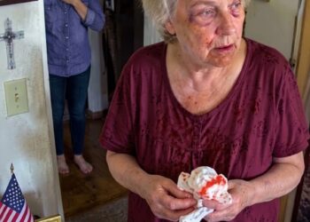 I came home early hoping to surprise my mother and wife, but what I saw in the kitchen stopped me in my tracks. Mom was in:ju:red, shaking with hunger, and desperately eating scraps while my wife relaxed nearby, laughing over a glass of wine. “She’s just being dramatic,” my wife said. I looked at the marks on my mother, quietly locked the front door, and whispered, “Enjoy that wine. By tomorrow, you may have nothing left to celebrate.”